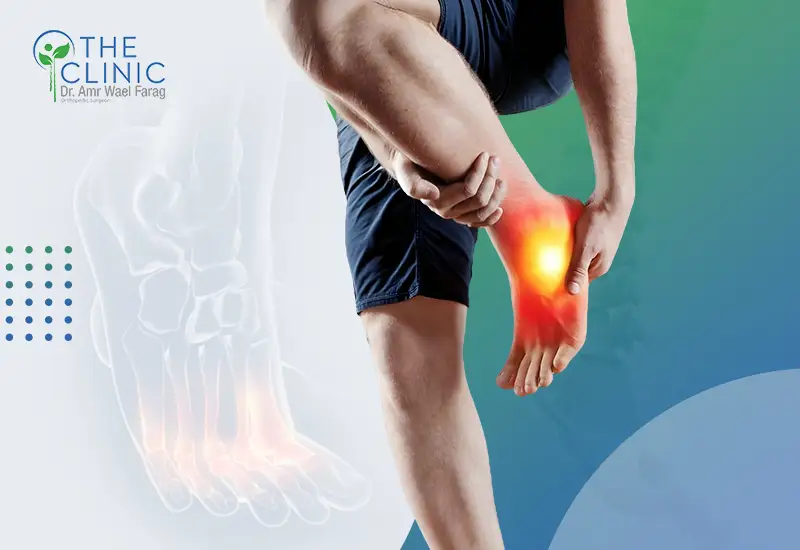 تعرف إلى أعراض كسر مشط القدم وعلاجه