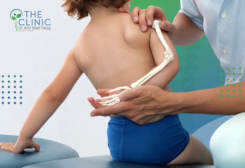 افضل-دكتور-جراحة-عظام-اطفال-فى-مصر أفضل دكتور جراحة عظام أطفال في مصر