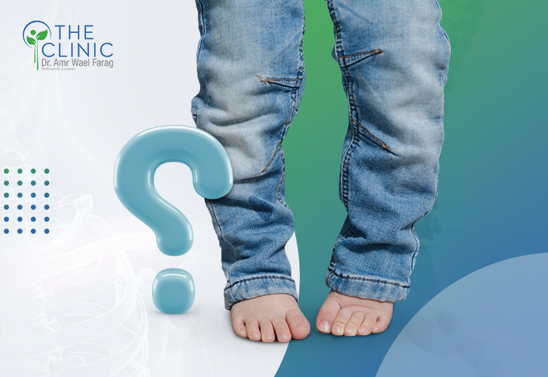 أسباب تقوس الساقين