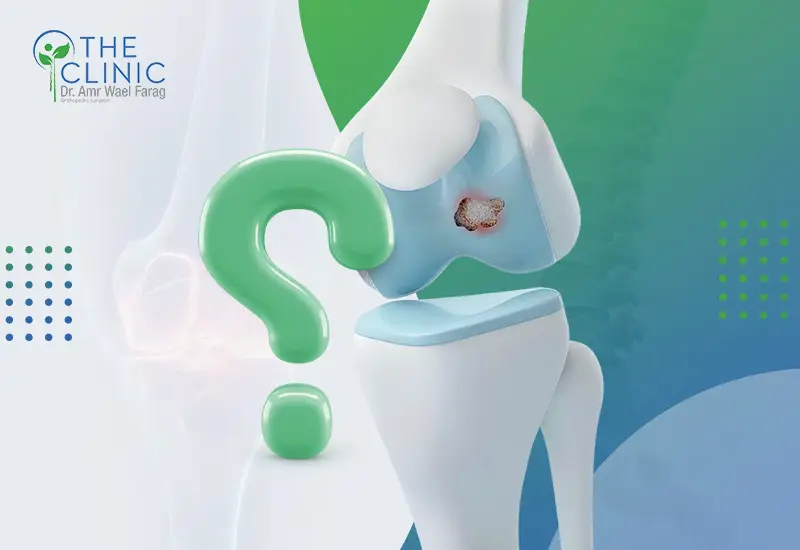 أسباب خشونة الركبة