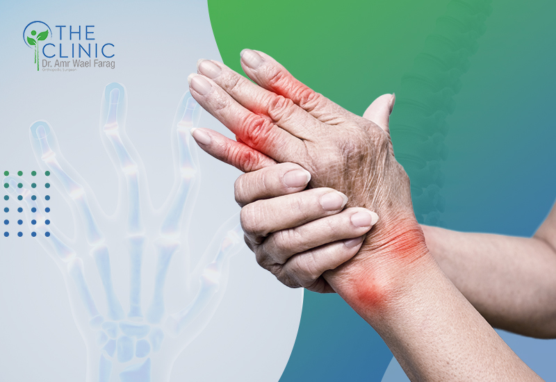 التهاب المفاصل الروماتويدي