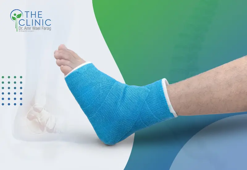 علاج تمزق أربطة الكاحل