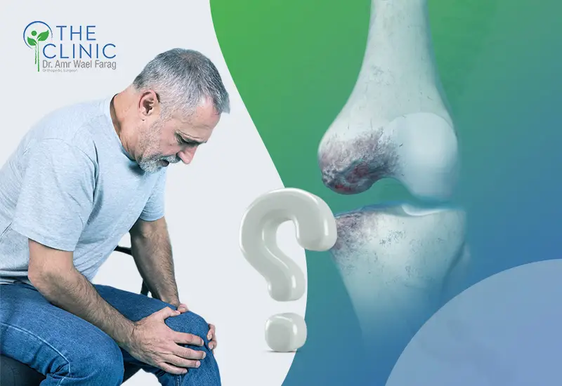 درجات خشونة الركبة