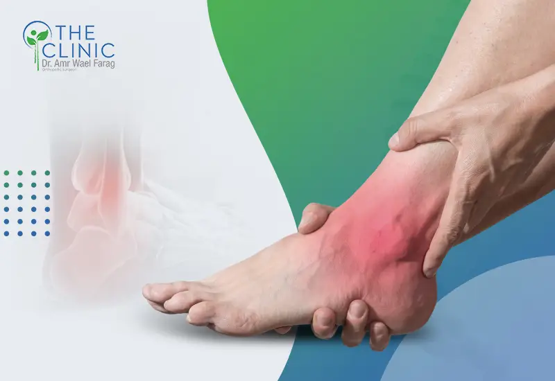 أعراض-الشوكة-العظمية أعراض الشوكة العظمية