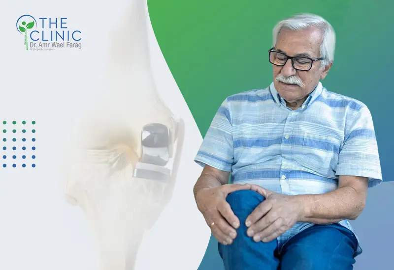 أضرار عملية تغيير مفصل الركبة
