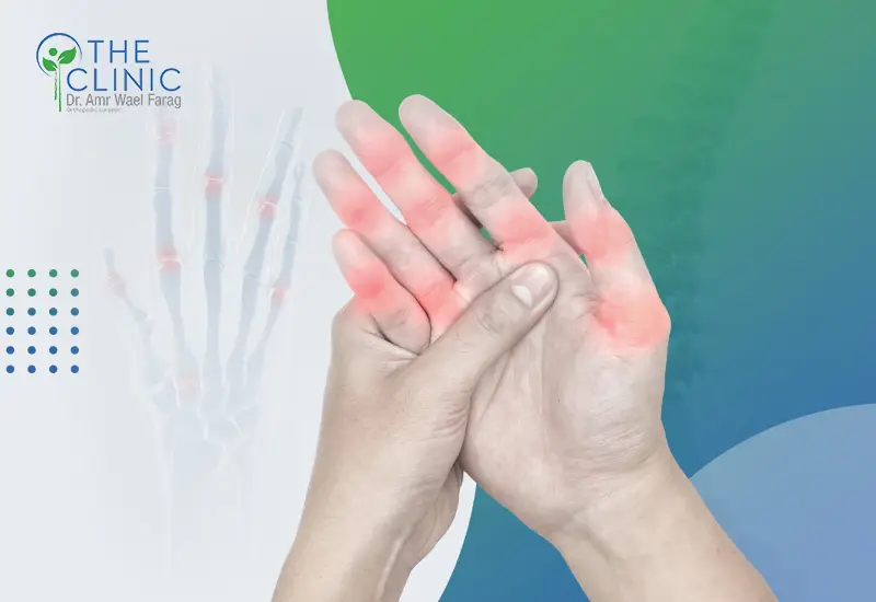 علاج الروماتويد