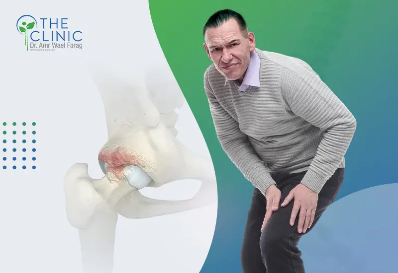 علاج خشونة مفصل الحوض