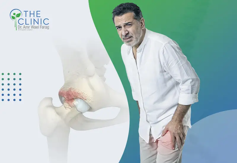 أعراض تآكل مفصل الحوض