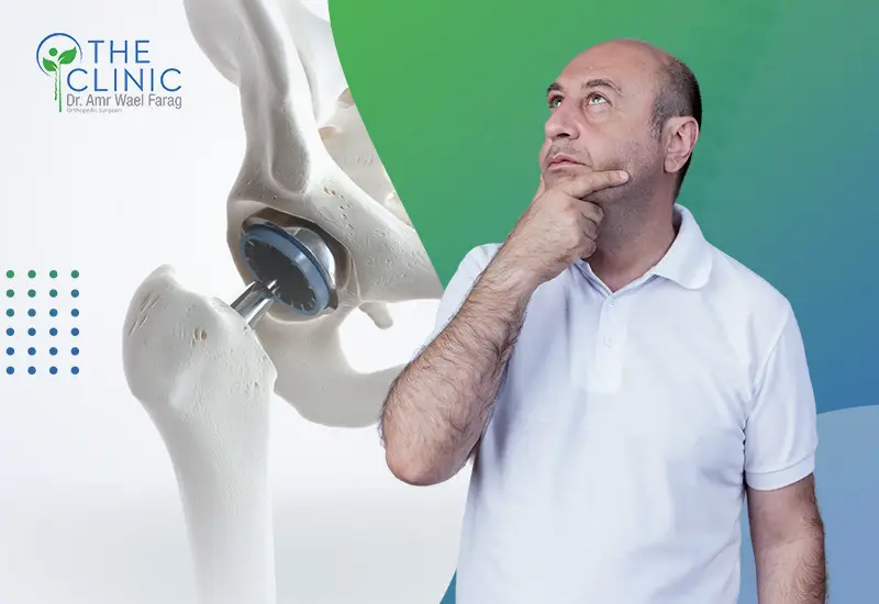 مخاطر عملية تغيير مفصل الحوض